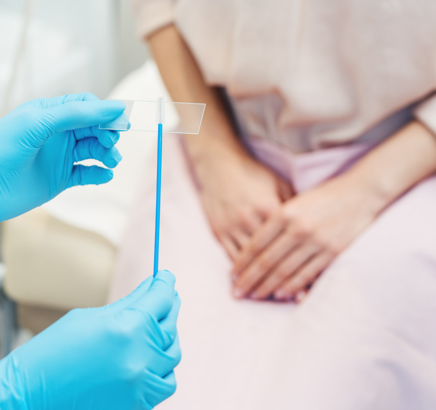what to expect from your smear test