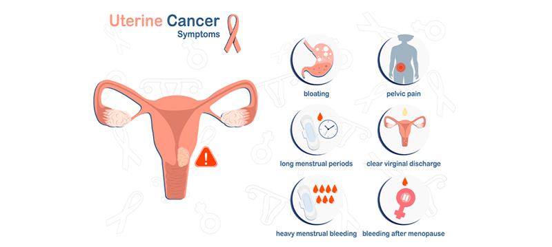 How to Spot Early Signs of Uterine Cancer: Symptoms, Causes, and When to See a GP